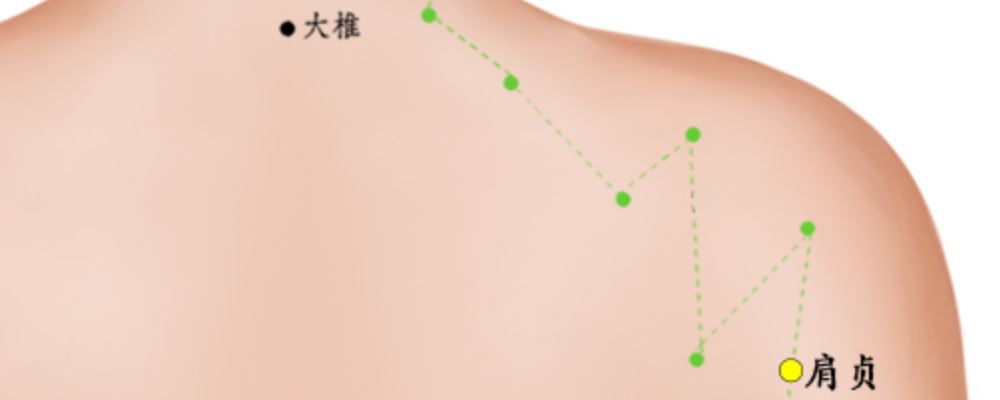 肩貞穴位的準(zhǔn)確位置圖